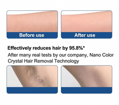 Circular Hair Eraser for Sensitive Areas – Gold with Handle