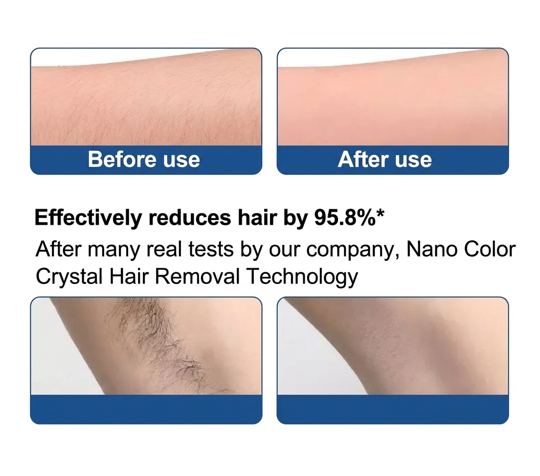 Circular Hair Eraser for Sensitive Areas – Gold with Handle
